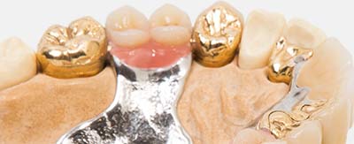 Dental Gold